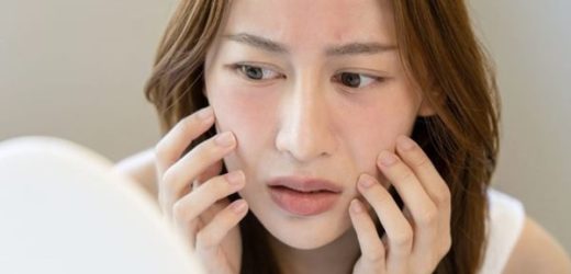 Nóng mặt là điềm gì?